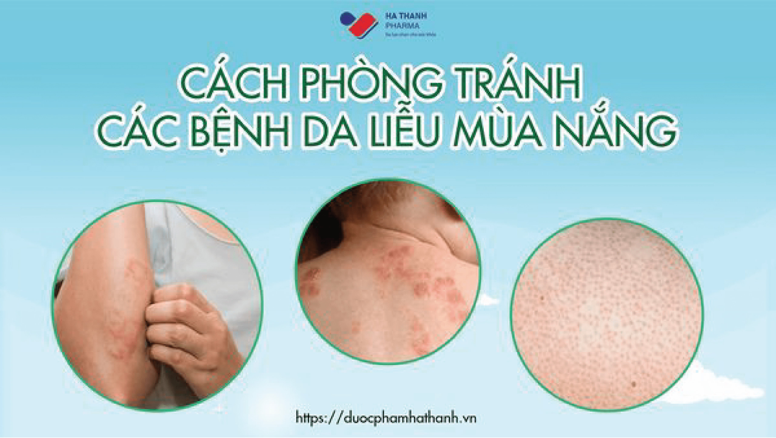 HÈ TỚI !! 🌤️🌤️ CÁCH PHÒNG BỆNH DA LIỄU MÙA NẮNG